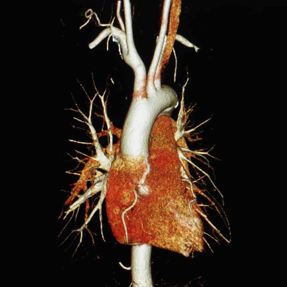 inner_image_02 https://tayfun.codeven.co/wp-content/uploads/2021/08/inner_image_02.jpg