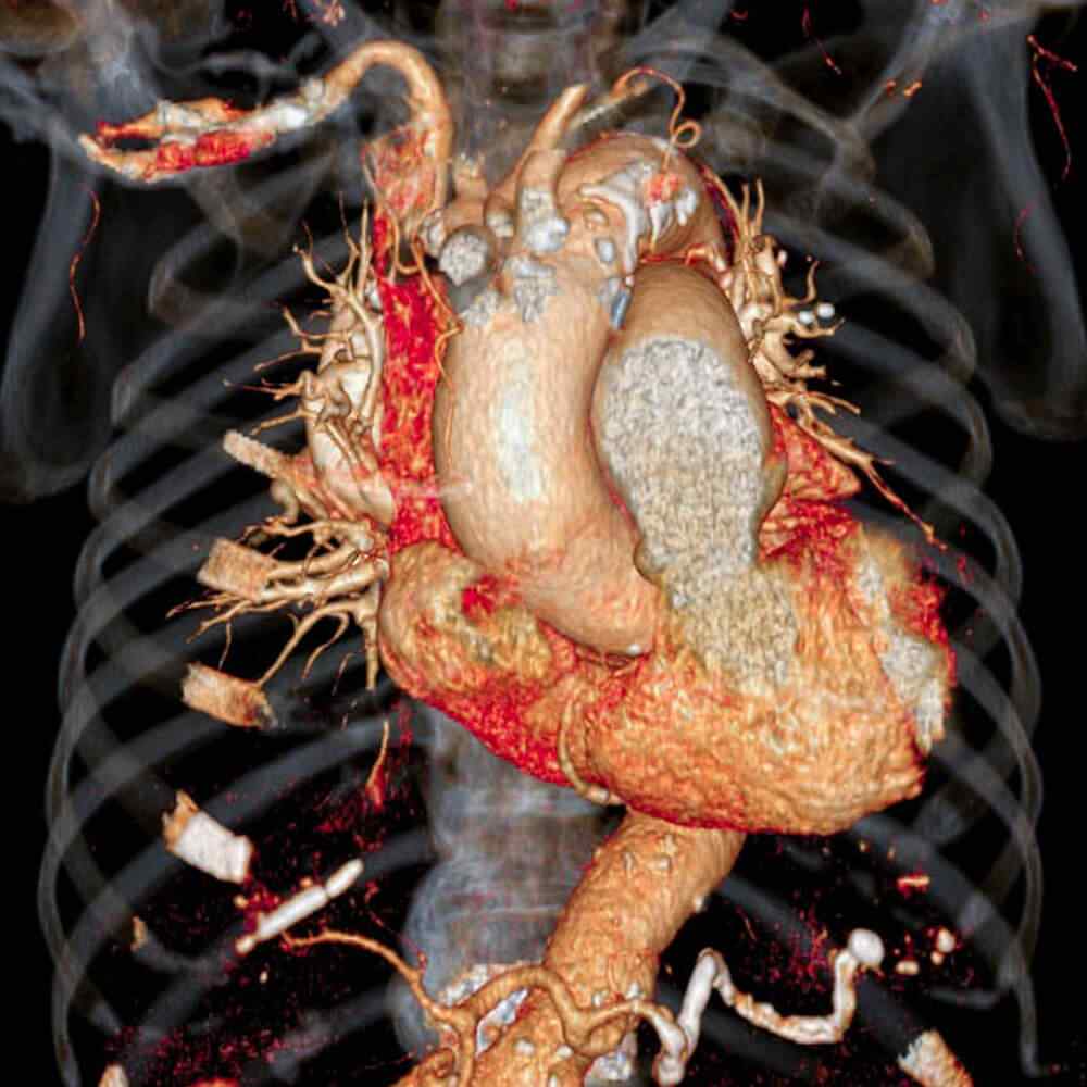 inner_image_03 https://tayfun.codeven.co/wp-content/uploads/2021/08/inner_image_03.jpg