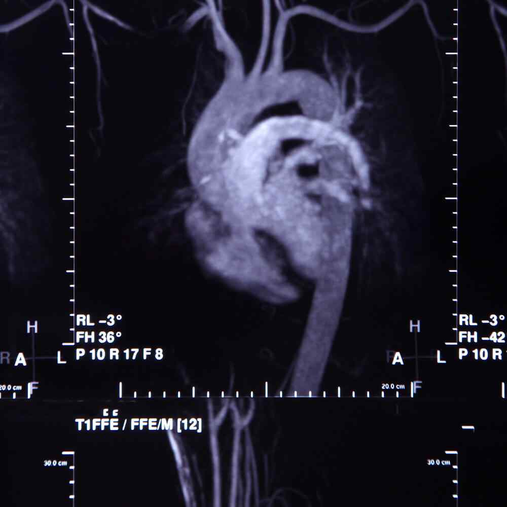 inner_image_05 https://tayfun.codeven.co/wp-content/uploads/2021/08/inner_image_05.jpg